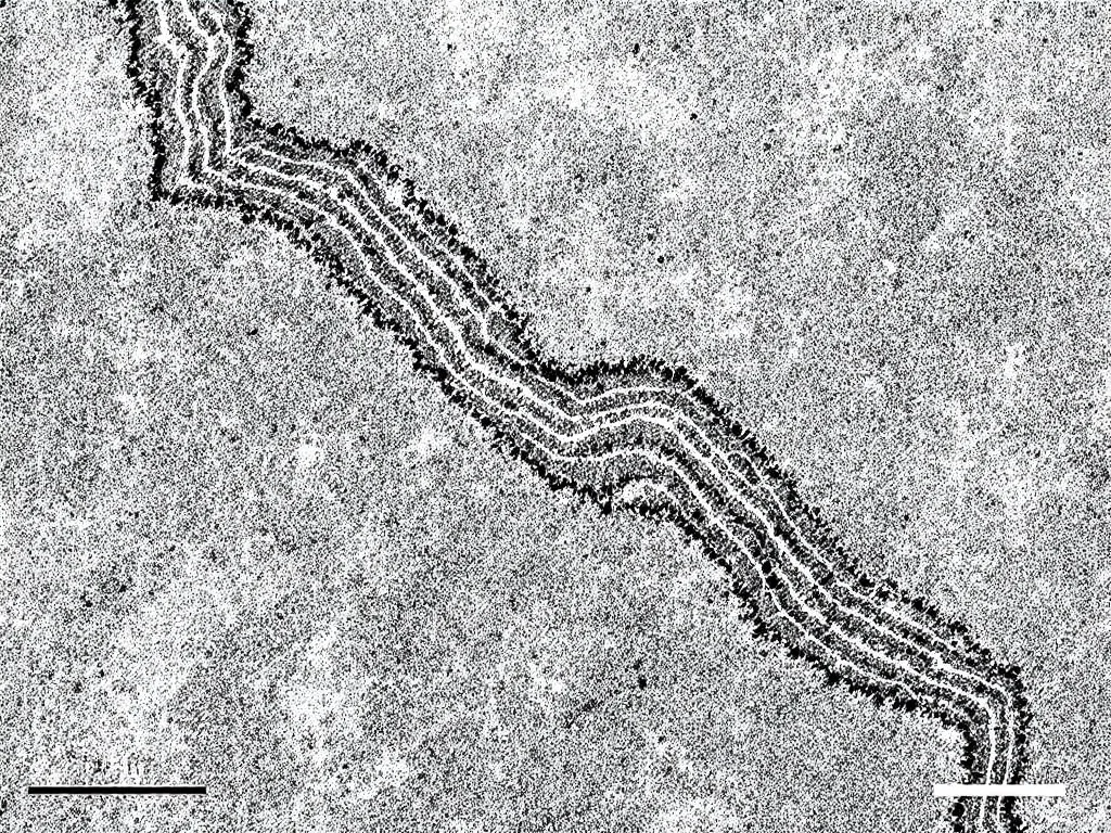 Microstructure of martensite formation in quenched steel